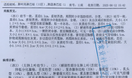 老公刚刚54岁，确诊肺癌，手术中发现转移，病理晚期